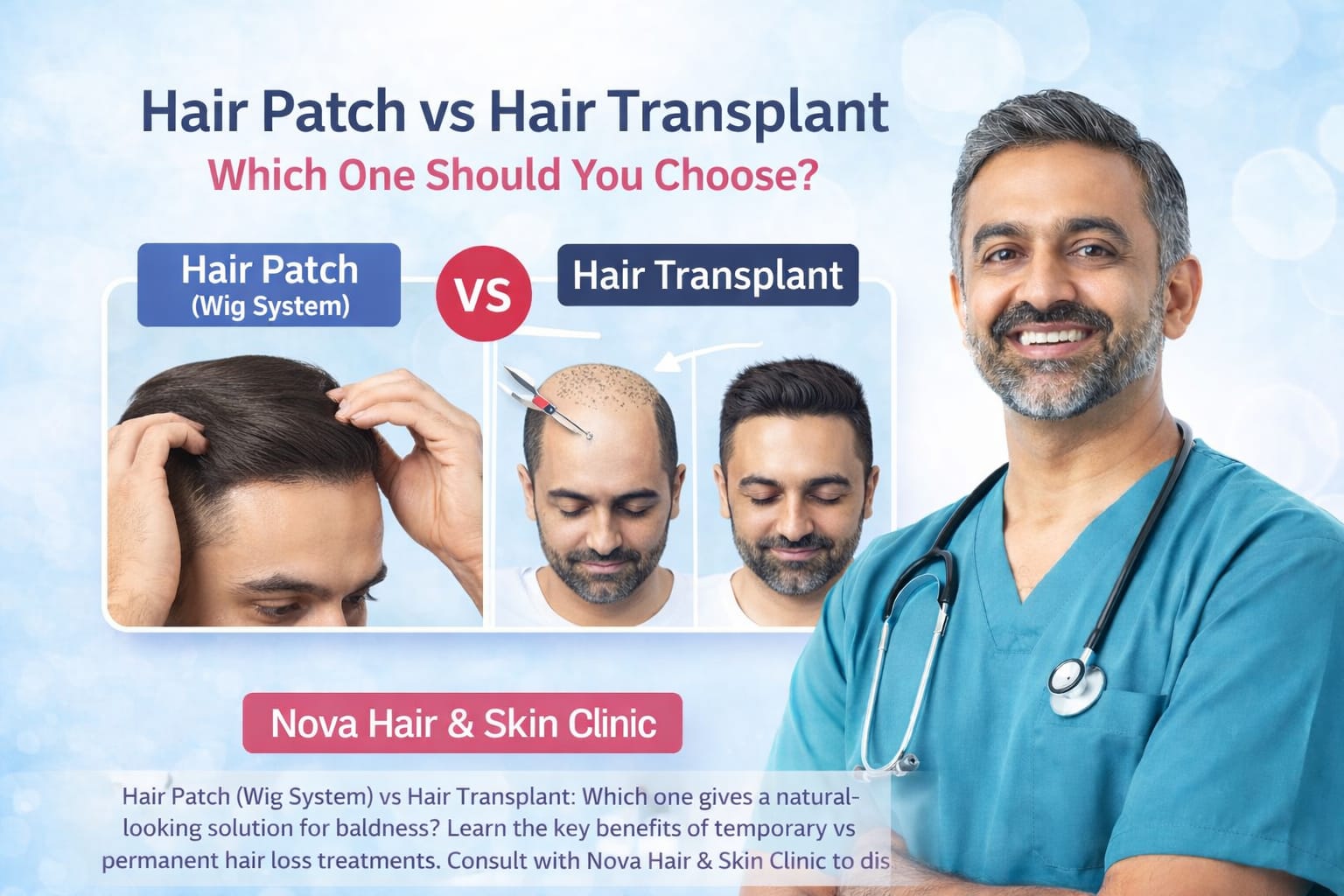 hair-patch-vs-hair-transplant