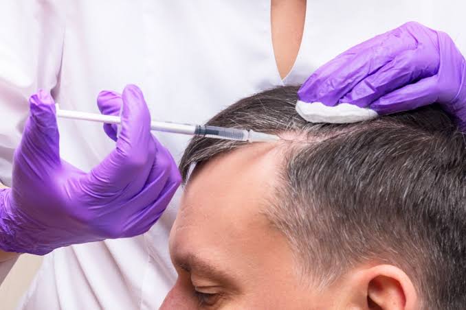 Hair Restoration Therapy / Mesotherapy