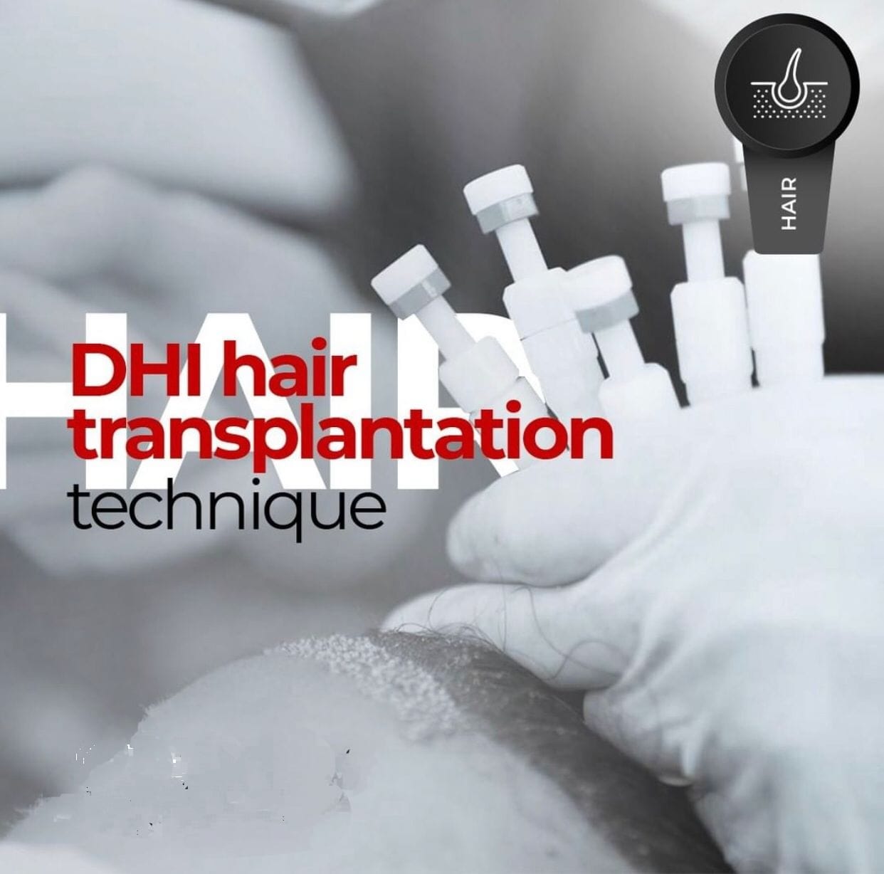 Dhi    ( Direct Hair Implantation )