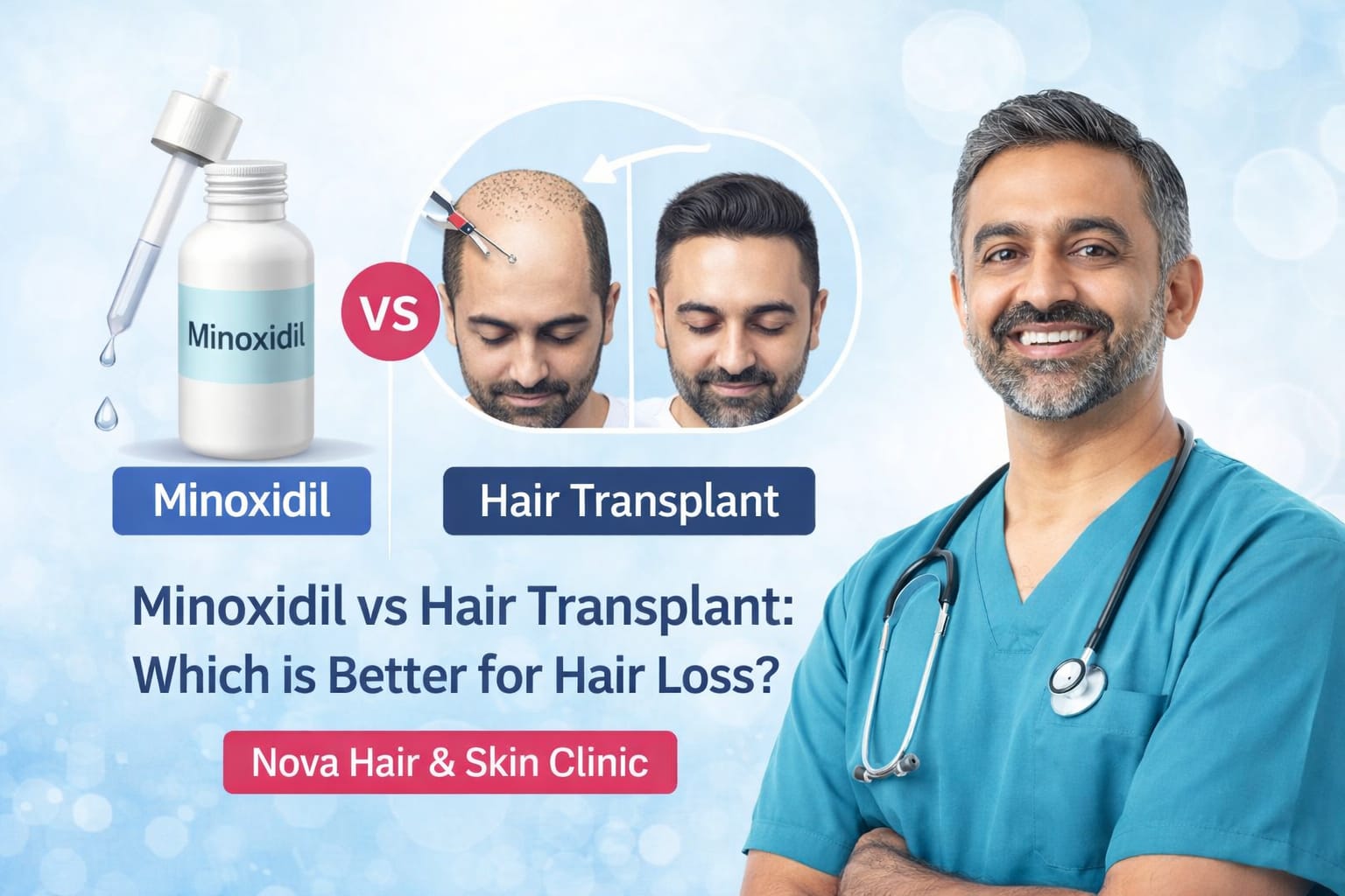 minoxidil-vs-hair-transplant