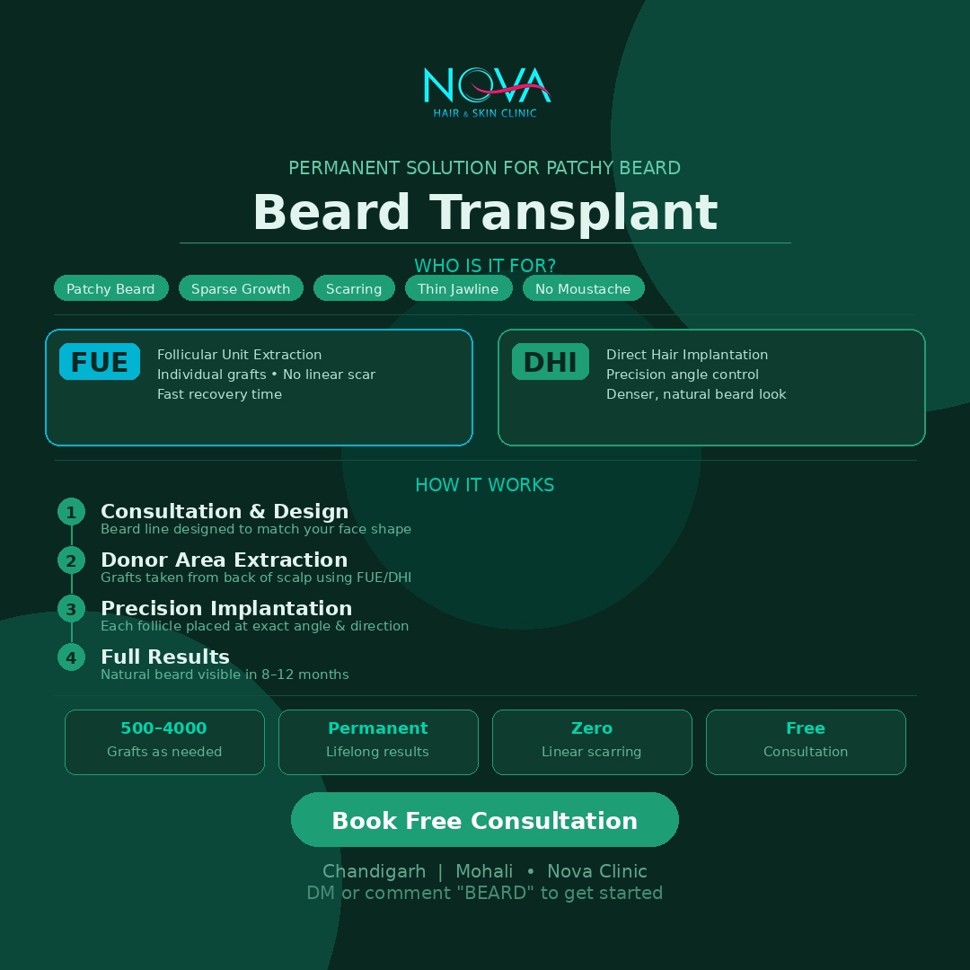 Beard-Transplant-in-Chandigarh