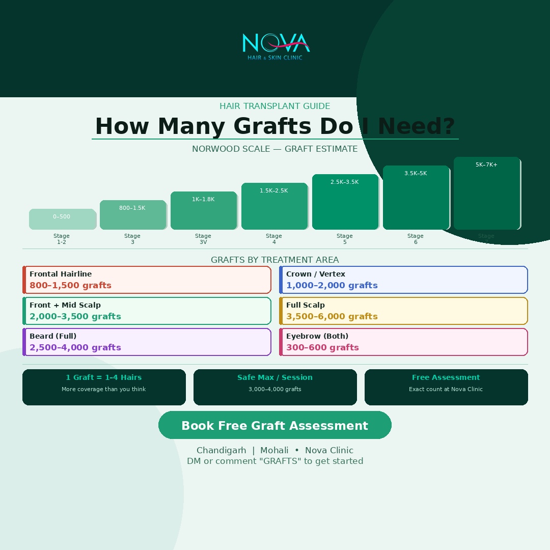 How-Many-Grafts-Do-I-Need