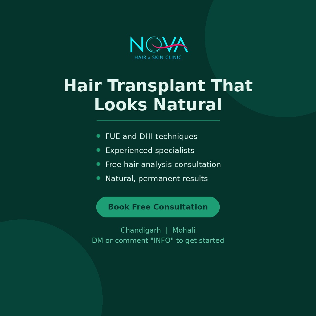Hair-Transplant-in-Chandigarh-Mohali